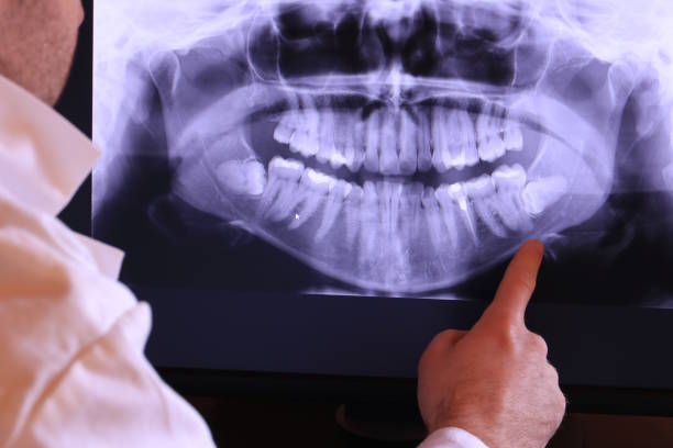 Best Emergency Root Canal Treatment in New Carlisle, IN