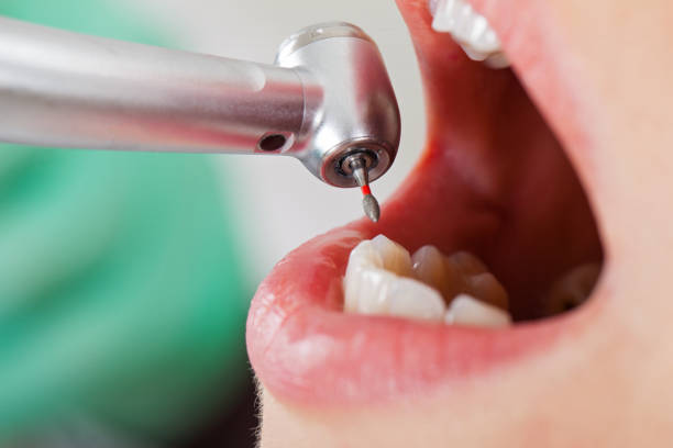 Best Pediatric Emergency Dentist in New Carlisle, IN